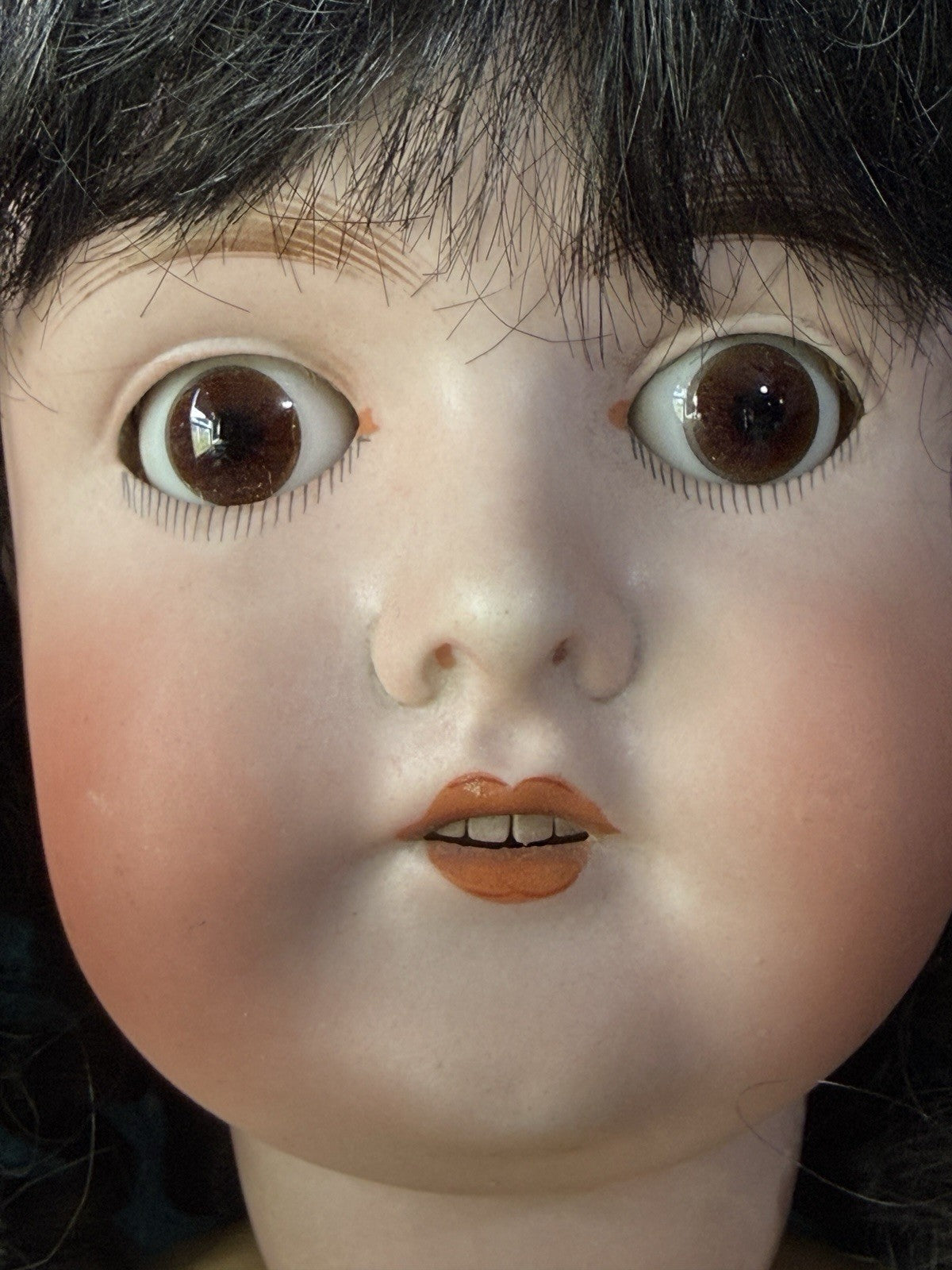 Antique German Queen Louise Doll Bisque Head Composition Body 24” Doll - Damaged