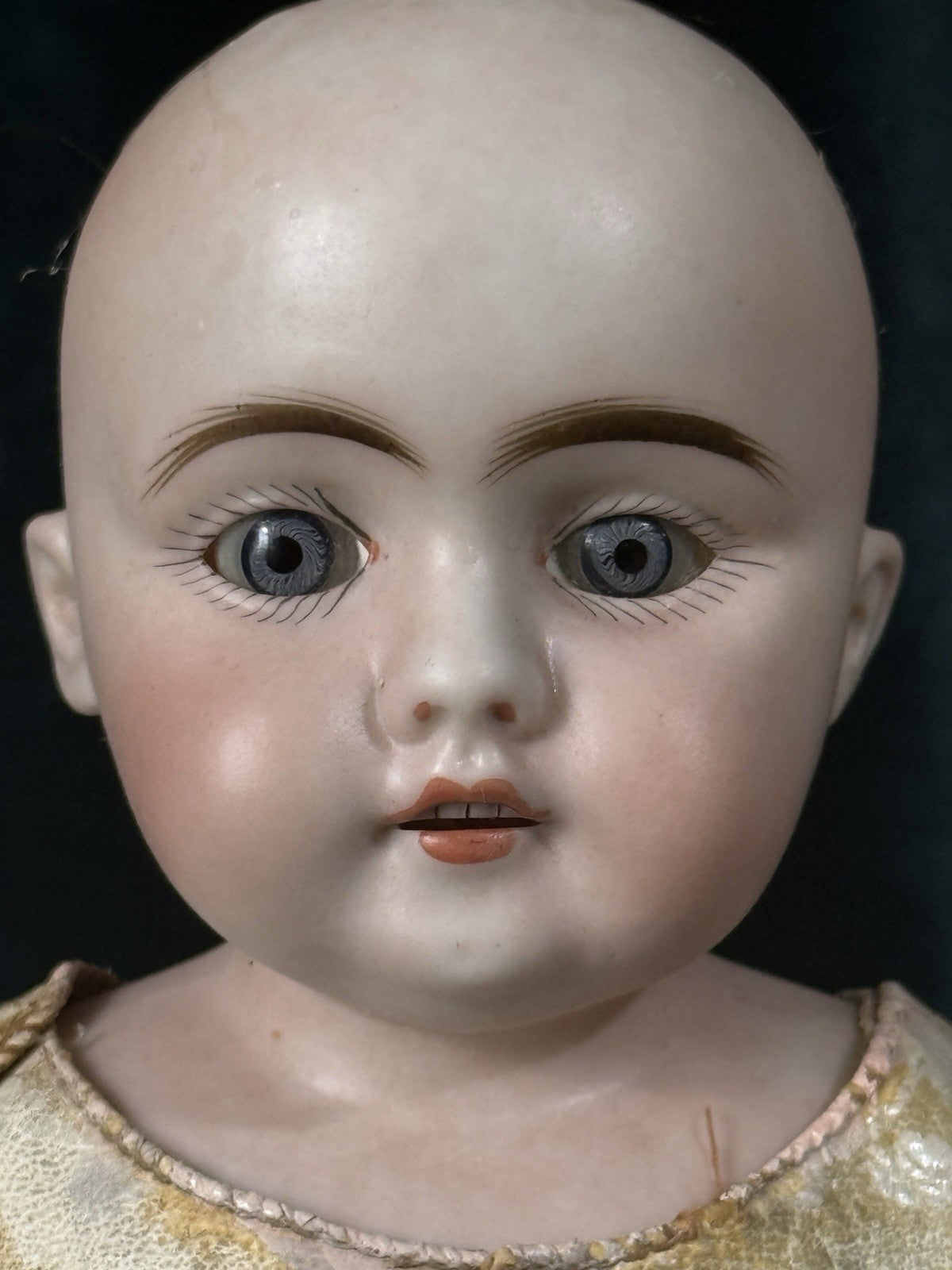 Antique German 12” Early Kestner Mold 143 Type Square Teeth Bisque Head Doll